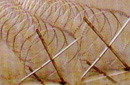 Concertina razor barbed wire